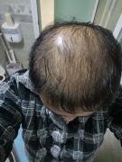 没想到遇到的增发纤维效果真的不错