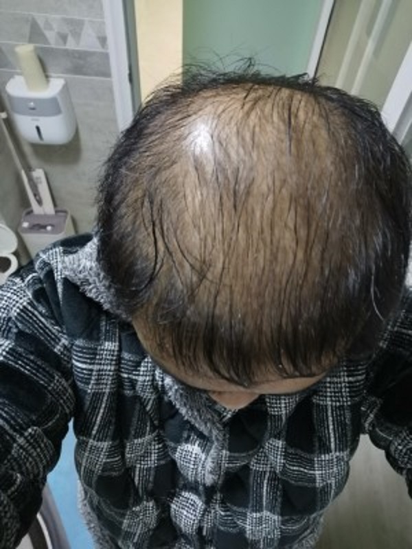 没想到遇到的增发纤维效果真的不错