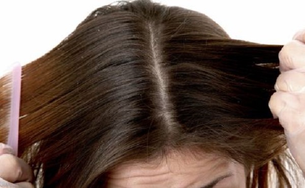 经常扣头皮会有什么危害