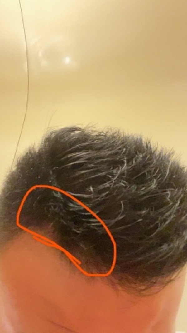 选择增发纤维是一个正确的选择