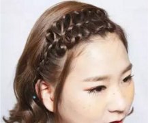 严重脱发算不算是病？