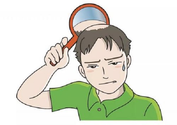 斑秃真的会自愈吗