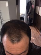 增发纤维让我开始了打造头发之旅