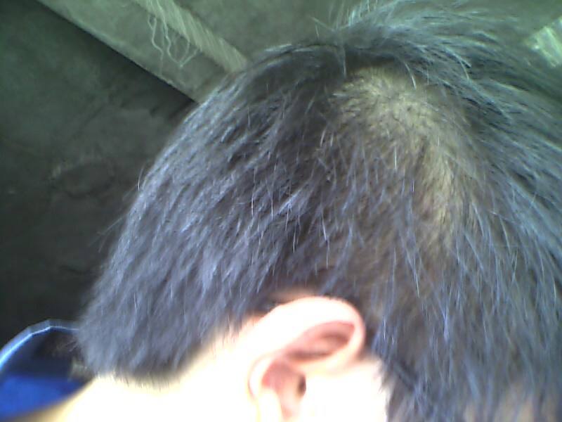 男性脱发都是什么原因引起的?——生活习惯