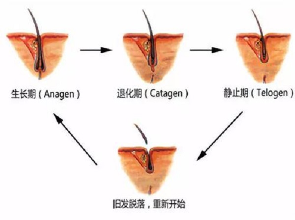 植发以后头发还会再掉吗