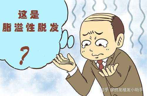 脂溢性脱发可以彻底治疗好吗?——脂溢性脱发的治疗方法