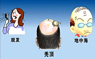 了解毛发移植的步骤——分离毛囊