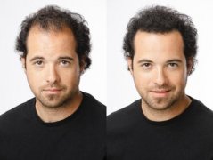 还好有增发纤维，头发稀疏再也不怕了