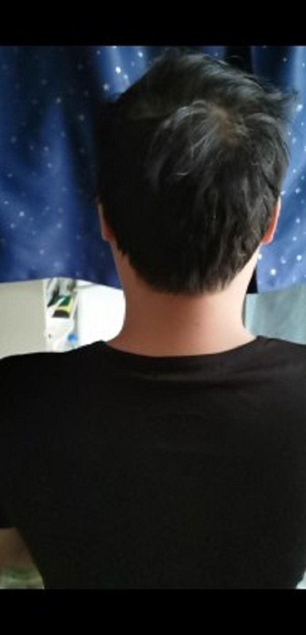 增发纤维帮助我恢复了形象