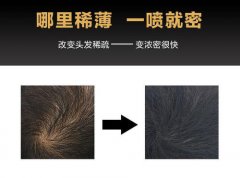 苏玫氏头发纤维粉有哪些好处?