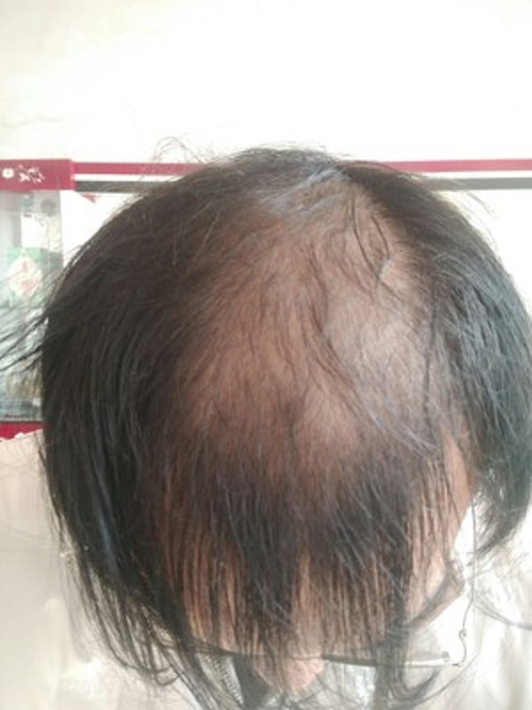 增发纤维的效果比想象的要好