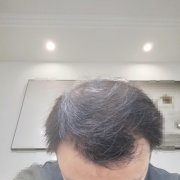 有了增发纤维之后我可以自信的走出去了