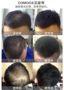 头发纤维粉，让我拥有拾起信心的力量