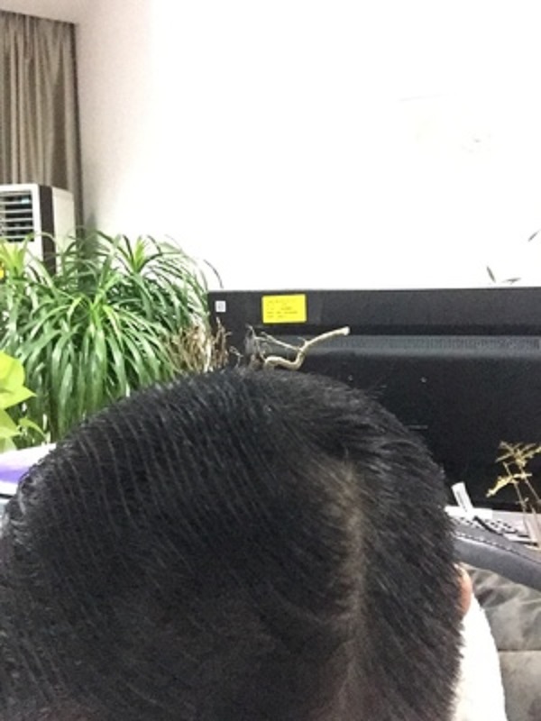 头发变密的秘密武器：增发纤维