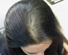 产后建议多久洗一次头发好