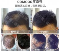 增发纤维使用时间长了对头皮有伤害吗？