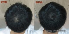 头发稀疏怎么办？头发纤维粉来帮忙