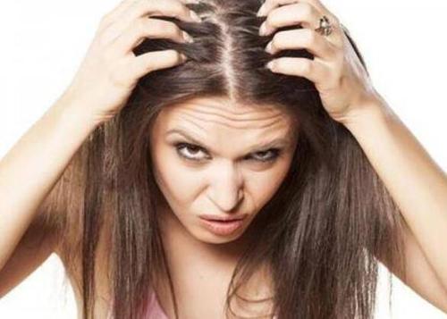 头发出油量多会导致脱发吗？