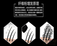 只需一招就能摆脱脱发烦恼