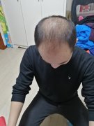 增发纤维对我所产生的影响