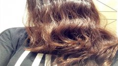 都有什么原因会导致20多岁的人脱发