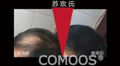 苏玫氏头发纤维粉，让我变得更加自信