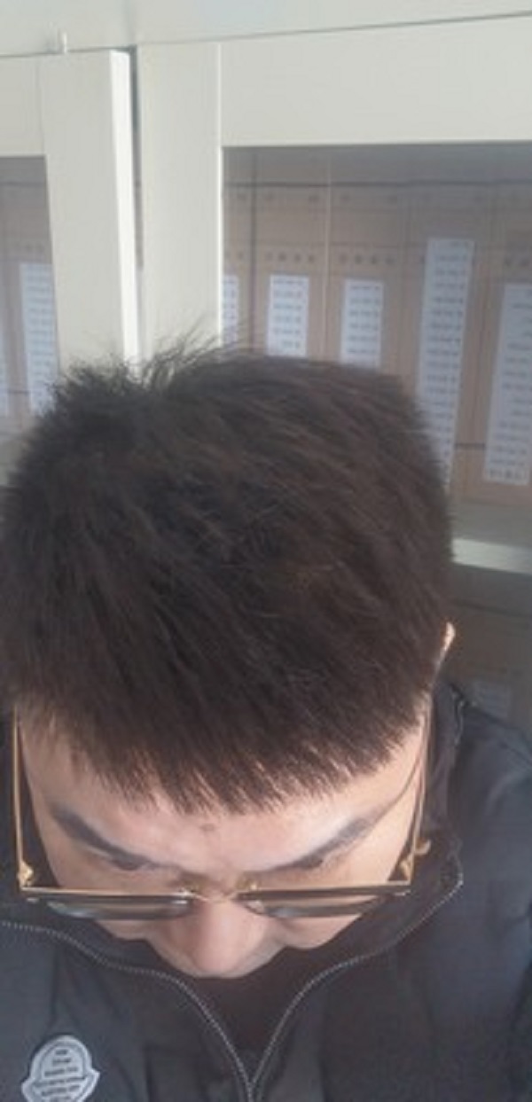 增发纤维带来的惊喜