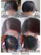 苏玫氏头发纤维粉，让我从“头”开始