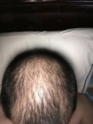 看来以后是离不开增发纤维了