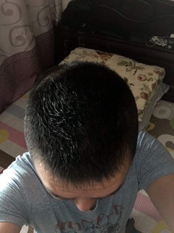 看来以后是离不开增发纤维了