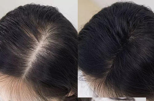 苏玫氏头发纤维粉