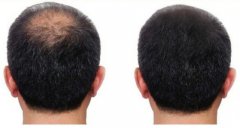 很幸运遇见了头发纤维粉