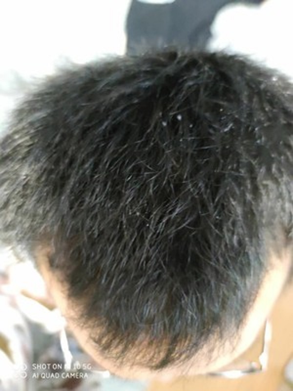 增发纤维的效果简直太棒了