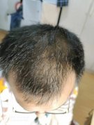 增发纤维的效果简直太棒了