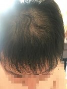 幸好没有错过增发纤维