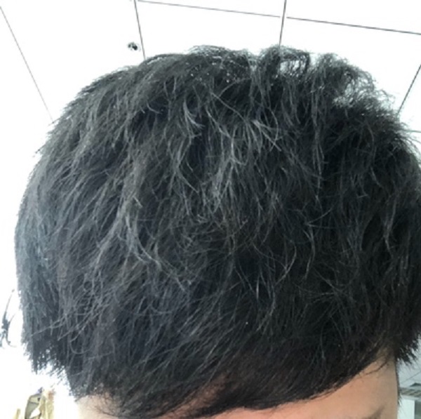 重获自信的关键：增发纤维