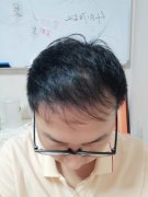 增发纤维助我摆脱烦恼