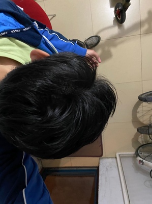 增发纤维助你找回自信