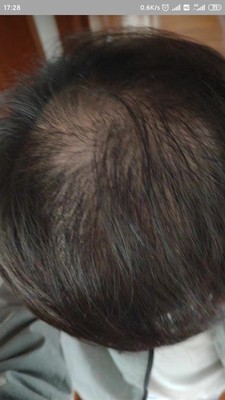 增发纤维解决了我人生中的大事