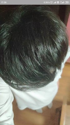 增发纤维解决了我人生中的大事