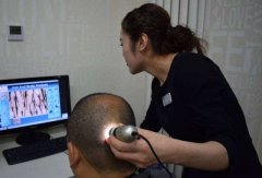 秃顶和毛囊坏死有关系吗