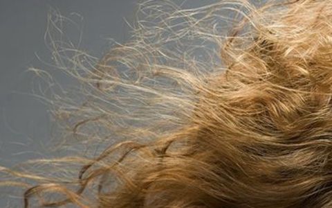 头发差可以反应出身体健康问题吗？