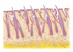 植发后为什么会有毛囊炎