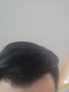 增发纤维让我看到了奇迹