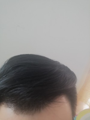 增发纤维让我看到了奇迹