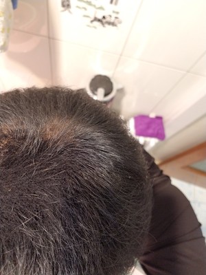 增发纤维让我的头发变密了