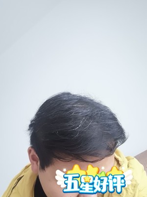 增发纤维简直是我的意外惊喜