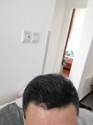 感谢遇到增发纤维