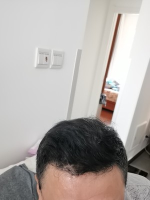 感谢遇到增发纤维