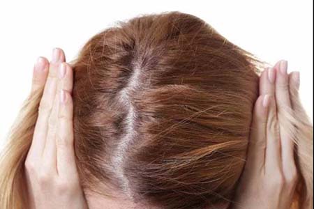 产后掉发需要补充什么营养？